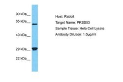 PRSS53 Rabbit anti-Human, Polyclonal, Novus Biologicals 0.1 mL | Buy Online | Novus Biologicals | Fisher Scientific